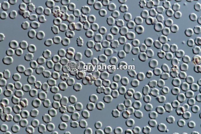 Hématies A et sérum anti-B (absence d'agglutination) x160 - gryphea.org